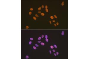 Immunofluorescence analysis of U-2 OS cells using ZBTB7A/FBI-1/LRF Rabbit mAb (ABIN7271439) at dilution of 1:100 (40x lens). (ZBTB7A Antikörper)