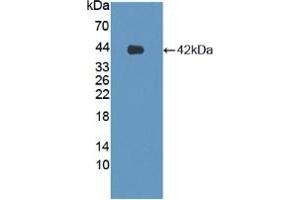 Detection of Recombinant LPHN3, Human using Polyclonal Antibody to Latrophilin 3 (LPHN3) (LPHN3 Antikörper  (AA 1105-1447))