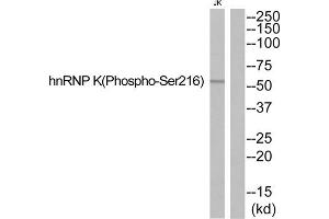 Western blot analysis of extracts from JurKat cells, using hnRNP K (Phospho-Ser216) antibody. (HNRNPK Antikörper  (pSer216))
