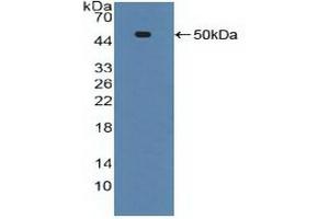 Detection of Recombinant ADRbK1, Human using Polyclonal Antibody to Tumor Necrosis Factor Receptor 1 (TNFR1) (TNFRSF1A Antikörper  (AA 60-236))