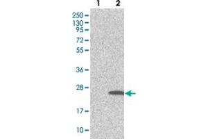 Western blot analysis of Lane 1: Negative control (vector only transfected HEK293T lysate). (TMEM159 Antikörper)