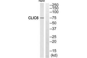 Western blot analysis of extracts from HepG2 cells, using CLIC6 antibody. (CLIC6 Antikörper)