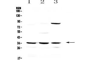Western blot analysis of Alpha 1 microglobulin using anti-Alpha 1 microglobulin antibody . (AMBP Antikörper  (AA 206-352))