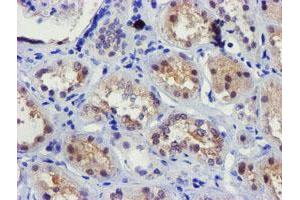 Immunohistochemical staining of paraffin-embedded Human Kidney tissue using anti-FBXO21 mouse monoclonal antibody. (FBXO21 Antikörper)