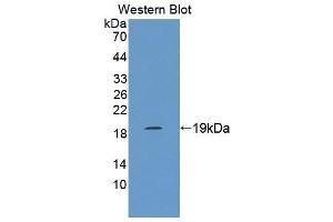 Detection of Recombinant MARCO, Rat using Polyclonal Antibody to Macrophage Receptor With Collagenous Structure (MARCO) (MARCO Antikörper  (AA 367-519))
