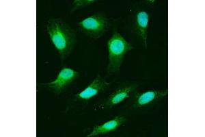 IF analysis of USP25 using anti-USP25 antibody (ABIN7598940). (USP25 Antikörper  (AA 1-1053))
