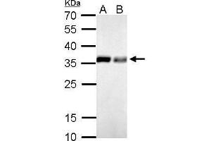 WB Image PPA1 antibody detects PPA1 protein by Western blot analysis. (Pyrophosphatase (Inorganic) 1 (PPA1) Antikörper)