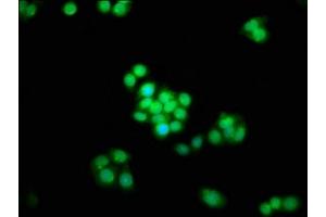 Immunofluorescence staining of PC-3 cells with ABIN7170484 at 1:133, counter-stained with DAPI. (SPAG8 Antikörper  (AA 236-409))