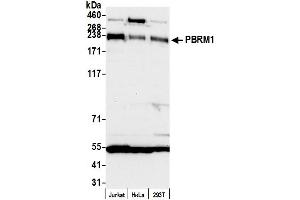 Western Blotting (WB) image for anti-Polybromo 1 (PBRM1) (AA 1639-1689) antibody (ABIN7453903)