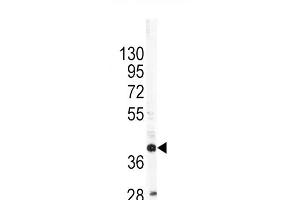 Western blot analysis of OL1 Antibody (C-term) 7361b in SK-Br-3 cell line lysates (35 μg/lane). (APOL1 Antikörper  (C-Term))