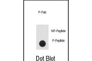 Dot blot analysis of anti-Phospho-CLASP1-p Antibody (ABIN6241038 and ABIN6578931) on nitrocellulose membrane.