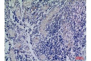 Immunohistochemistry (IHC) analysis of paraffin-embedded Human Brain, antibody was diluted at 1:100. (CXCR3 Antikörper  (Internal Region))