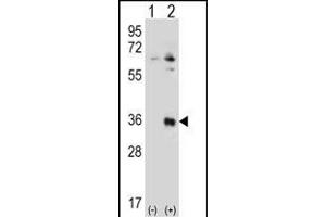 Western blot analysis of TSSK6 (arrow) using rabbit polyclonal TSSK6 Antibody (N-term) (ABIN656395 and ABIN2845690). (TSSK6 Antikörper  (N-Term))