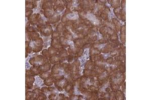 Immunohistochemical staining of human pancreas with RPS19BP1 polyclonal antibody  shows strong cytoplasmic with additional nucleolar positivity in exocrine glandular cells at 1:500-1:1000 dilution.