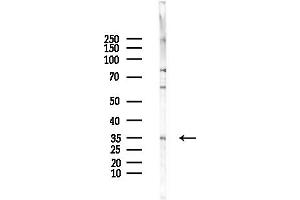 Western blot analysis of lysates from HepG2 cells(LPS,4h treatment), using RPL5 Antibody at 1/1000 dilution.