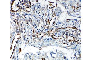 Immunohistochemistry (IHC) image for anti-VEGF Receptor 2 (VEGFR2) (AA 454-469), (Middle Region) antibody (ABIN3044301)