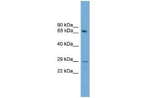WB Suggested Anti-Rgs18 Antibody Titration:  0. (RGS18 Antikörper  (N-Term))