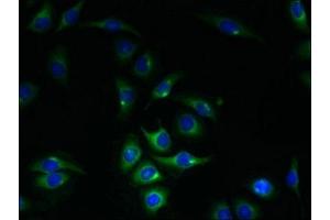 Immunofluorescent analysis of A549 cells using ABIN7150922 at dilution of 1:100 and Alexa Fluor 488-congugated AffiniPure Goat Anti-Rabbit IgG(H+L) (KIAA319L (AA 479-718) Antikörper)