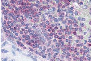 Human Spleen (formalin-fixed, paraffin-embedded) stained with XCR1 antibody ABIN213355 at 2. (XCR1 Antikörper  (Extracellular Domain))