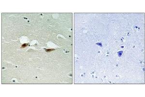 Immunohistochemical analysis of paraffin-embedded human brain tissue using ATF-2 (Phospho-Ser472) antibody (left)or the same antibody preincubated with blocking peptide (right). (ATF2 Antikörper  (pSer472))