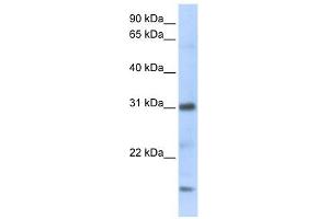 CXCL16 antibody used at 1 ug/ml to detect target protein. (CXCL16 Antikörper)