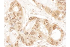anti-Chloride Channel, Nucleotide-Sensitive, 1A (CLNS1A) (AA 187-237) antibody
