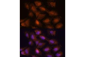 Immunofluorescence analysis of C6 cells using UPF3A antibody (ABIN7271227) at dilution of 1:100.
