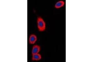 Immunofluorescent analysis of RPS6KC1 staining in Hela cells. (RPS6KC1 Antikörper)