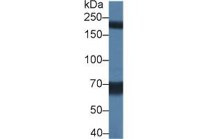 Detection of TRPM7 in Rat Serum using Polyclonal Antibody to Transient Receptor Potential Cation Channel Subfamily M, Member 7 (TRPM7) (TRPM7 Antikörper  (AA 19-179))