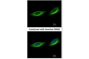 ICC/IF Image Immunofluorescence analysis of methanol-fixed HeLa, using TULP1, antibody at 1:500 dilution.