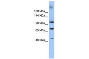Image no. 1 for anti-Terminal Uridylyl Transferase 1, U6 SnRNA-Specific (TUT1) (AA 253-302) antibody (ABIN6740335) (TUT1 Antikörper  (AA 253-302))