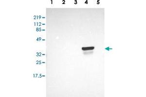 Western blot analysis of Lane 1: RT-4, Lane 2: EFO-21, Lane 3: A-431, Lane 4: Liver, Lane 5: Tonsil with OTC polyclonal antibody  at 1:250-1:500 dilution. (OTC Antikörper  (AA 172-299))