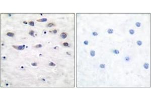 Immunohistochemistry analysis of paraffin-embedded human brain, using GluR1 (Phospho-Ser849) Antibody. (Glutamate Receptor 1 Antikörper  (pSer849))