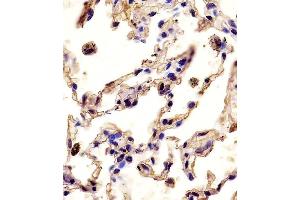 (ABIN390136 and ABIN2840640) staining P12 in human lung tissue sections by Iunohistochemistry (IHC-P - paraformaldehyde-fixed, paraffin-embedded sections).