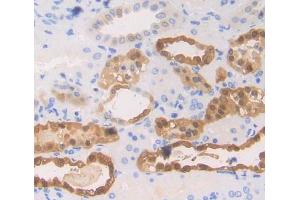 Immunohistochemistry (IHC) image for anti-Erythrocyte Membrane Protein Band 4.1 (Elliptocytosis 1, RH-Linked) (EPB41) (AA 210-497) antibody (ABIN5013511)