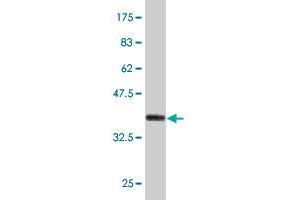 Western Blot detection against Immunogen (37. (LRRC2 Antikörper  (AA 272-371))