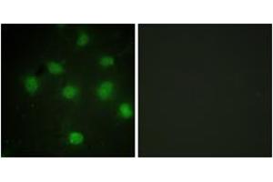 Immunofluorescence analysis of COS7 cells, using TLK1 (Ab-764) Antibody.