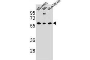 Western Blotting (WB) image for anti-C-Type Lectin Domain Family 17, Member A (CLEC17A) antibody (ABIN3000135) (CLEC17A Antikörper)