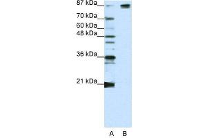 WB Suggested Anti-SF3B1  Antibody Titration: 1. (SF3B1 Antikörper  (Middle Region))