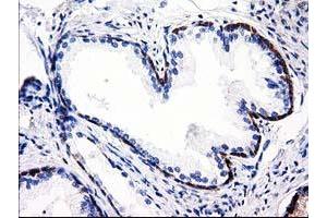 Immunohistochemical staining of paraffin-embedded Human Kidney tissue using anti-ALDH1L1 mouse monoclonal antibody. (ALDH1L1 Antikörper)