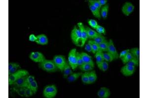 Immunofluorescence staining of HepG2 cells with ABIN7174645 at 1:100, counter-stained with DAPI.