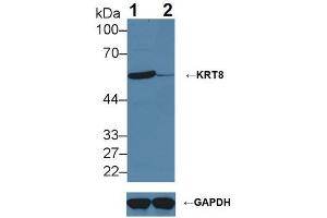 Knockout Varification: ;Lane 1: Wild-type Hela cell lysate; ;Lane 2: KRT8 knockout Hela cell lysate; ;Predicted MW: 54,57kDa ;Observed MW: 57kDa;Primary Ab: 2µg/ml Rabbit Anti-Human KRT8 Antibody;Second Ab: 0. (KRT8 Antikörper  (AA 92-393))