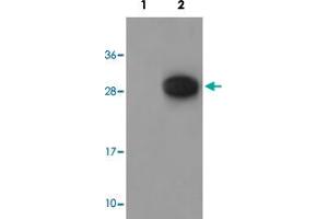 Western blot analysis of Lane 1: antigen-specific peptide treated 3T3 cells, Lane 2: 3T3 cells with GAB2 (phospho Y643) polyclonal antibody  at 1:500-1000 dilution. (GAB2 Antikörper  (pTyr643))