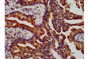 Immunohistochemistry (IHC) image for anti-Integrin beta-6 (ITGB6) (AA 451-586) antibody (ABIN7156494)