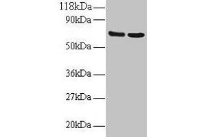 Western blot All lanes: IFITM1 antibody at 2 μg/mL Lane 1: EC109 whole cell lysate Lane 2: 293T whole cell lysate Secondary Goat polyclonal to rabbit IgG at 1/15000 dilution Predicted band size: 14 kDa Observed band size: 70 kDa (IFITM1 Antikörper  (AA 1-36))