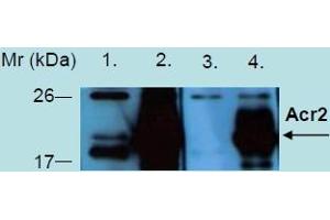 Western Blotting analysis of recombinant protein Acr2 produced in Escherichia coli BL21 (lambdaDE3) transfected bacterial culture. (Acr2 - heat stress induced ribosome binding protein A Antikörper)