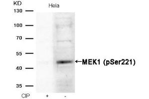 Western Blotting (WB) image for anti-Mitogen-Activated Protein Kinase Kinase 1 (MAP2K1) (pSer221) antibody (ABIN7138487)