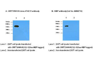 Western Blotting (WB) image for anti-Herpes Virus Type 8 (HHV8) (AA 122-329) antibody (ABIN371871) (HHV8 Antikörper  (AA 122-329))