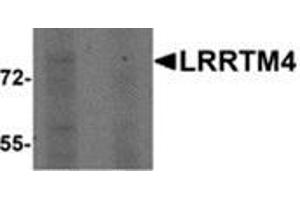 Western blot analysis of LRRTM4 in HeLa cell lysate with LRRTM4 antibody at 1 μg/ml in (left) the absence and (right) the presence of blocking peptide. (LRRTM4 Antikörper  (Center))