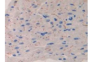 Immunohistochemistry (IHC) image for anti-Interleukin 11 Receptor, alpha (IL11RA) (AA 59-217) antibody (ABIN7437794)